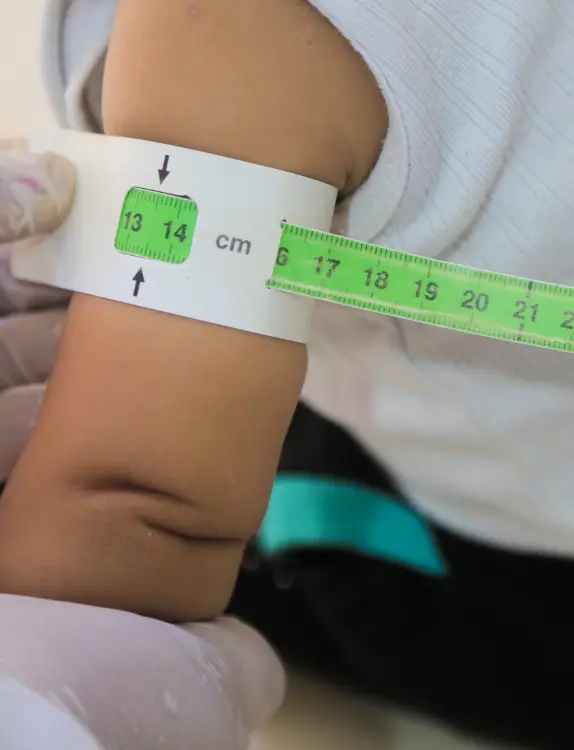 Desnutrición infantil Magaly Venegas morelia Desnutrición infantil Morelia